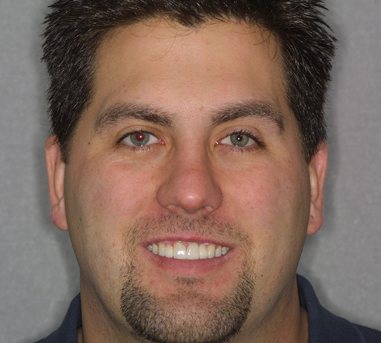 Brian Benedict Smile Makeover at World Class Dentistry