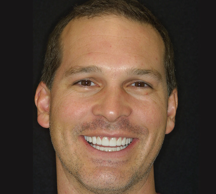 Kelly Powers Smile Makeover at World Class Dentistry